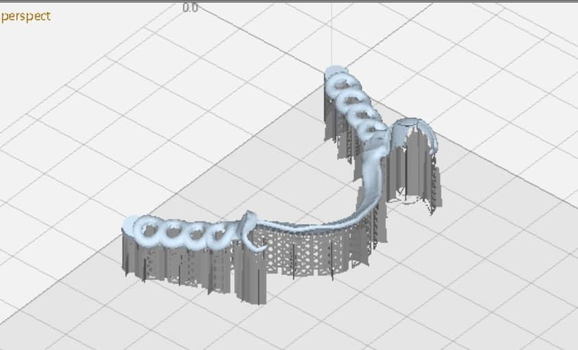 DeskArtes Releases 3Data Expert Version 16.0 AM Data Preparation Software3DPrint.com | Additive Manufacturing Business 2 dental restoration 2iwqEf