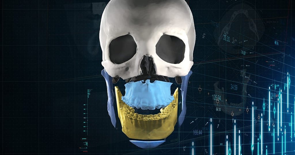 3D Printing Financials: Another Strong Quarter for Materialise’s Medical Segment3DPrint.com | Additive Manufacturing Business 2 og mimics enlight cmf orthognathic skull nLZiGc