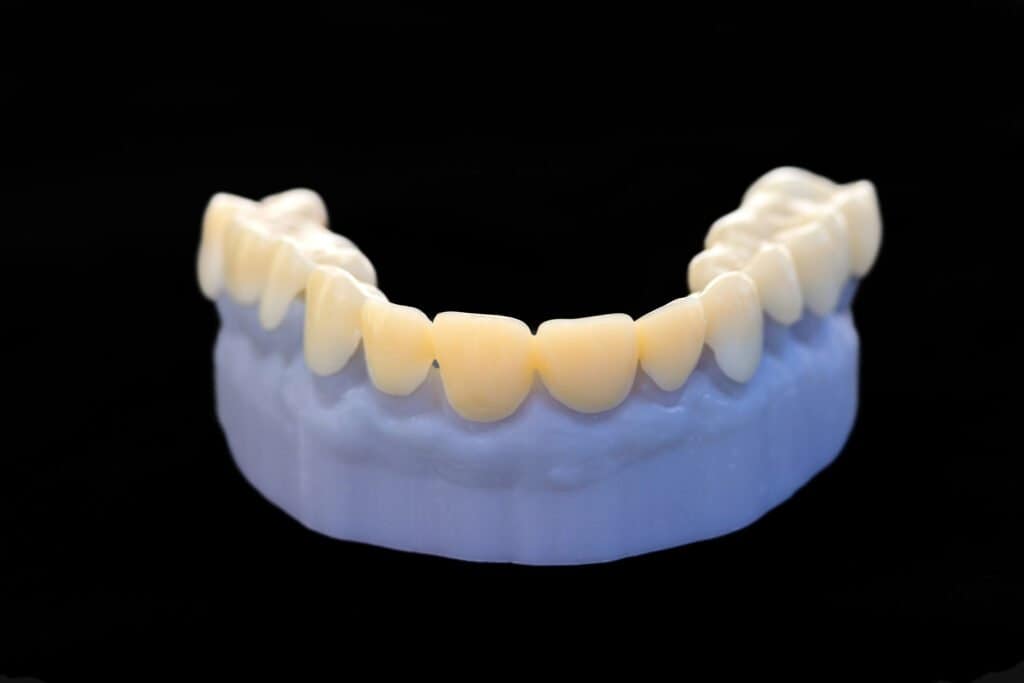 The Dental Additive Manufacturing Market Could Nearly Double by 2033, According to AM Research3DPrint.com | The Voice of 3D Printing / Additive Manufacturing 2 Dental 2025 1024x683 per8OV