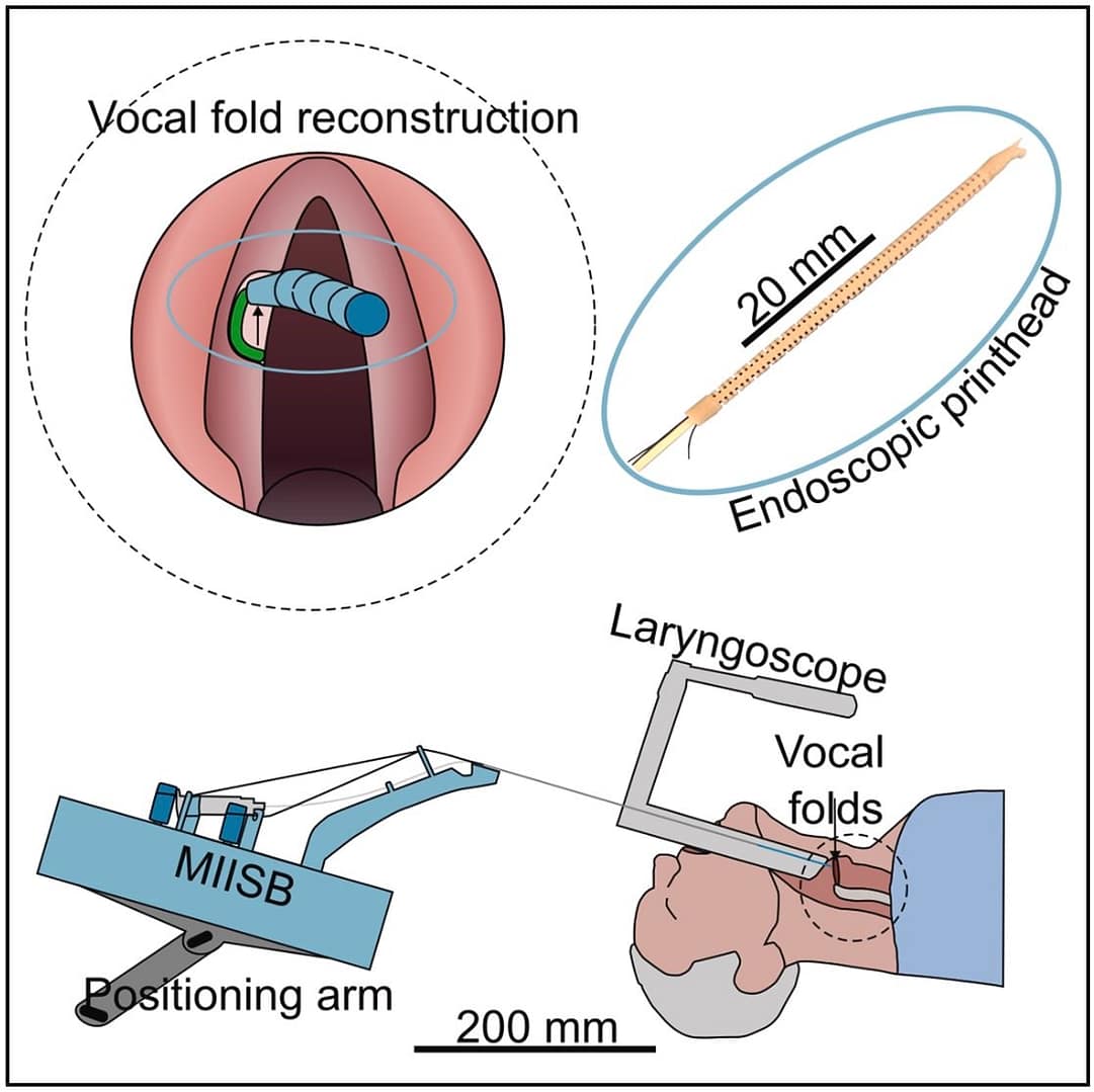Tiny Bioprinter Could One Day Repair Vocal Cords During Surgery3DPrint.com | Additive Manufacturing Business 7 sljdlk UKum6C