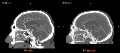 Stratasys’ RadioMatrix Could Mark the Beginning of the End for Cadavers in Imaging Training3DPrint.com | Additive Manufacturing Business 8 Stratasys RadioMatri US PR Image rHkg3S