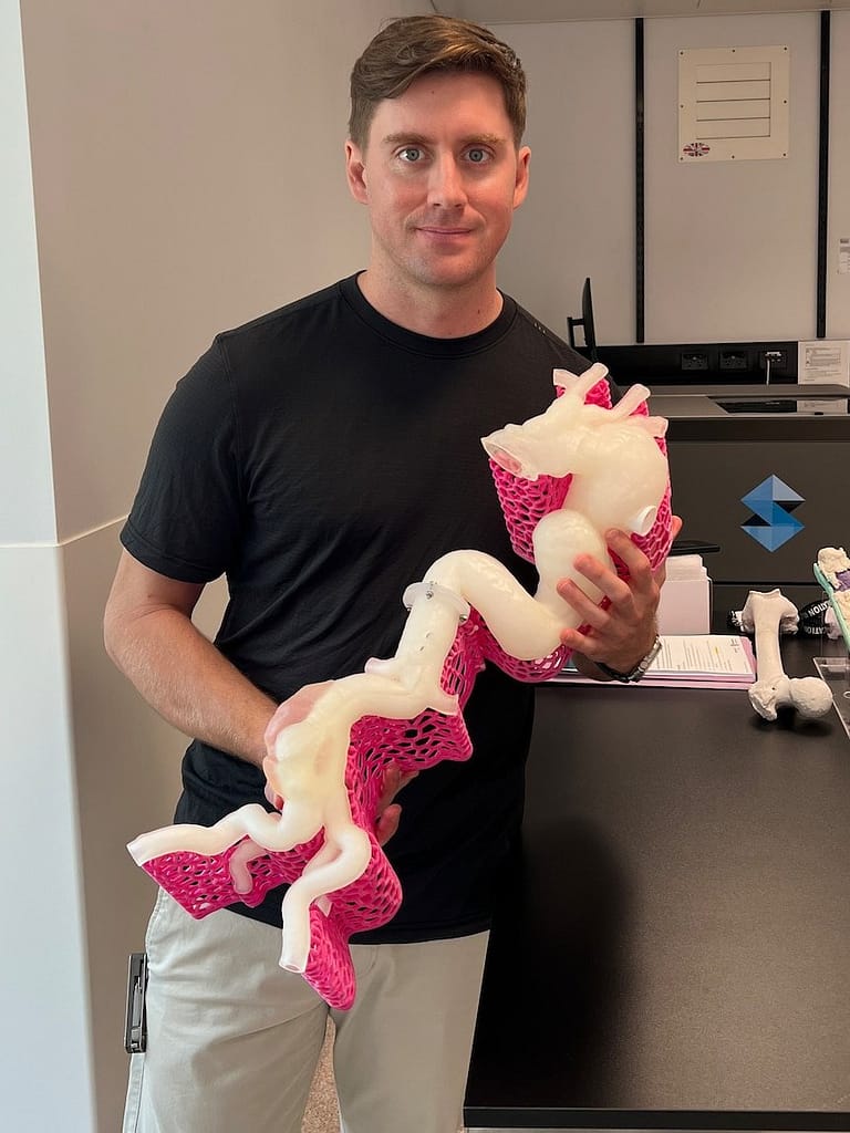 3D Printed Aorta Model Helps Surgeons Remove “Ticking Time Bomb” Artery3DPrint.com | The Voice of 3D Printing / Additive Manufacturing 2 1c38807a401941c67520085070a46320 fmmSX8