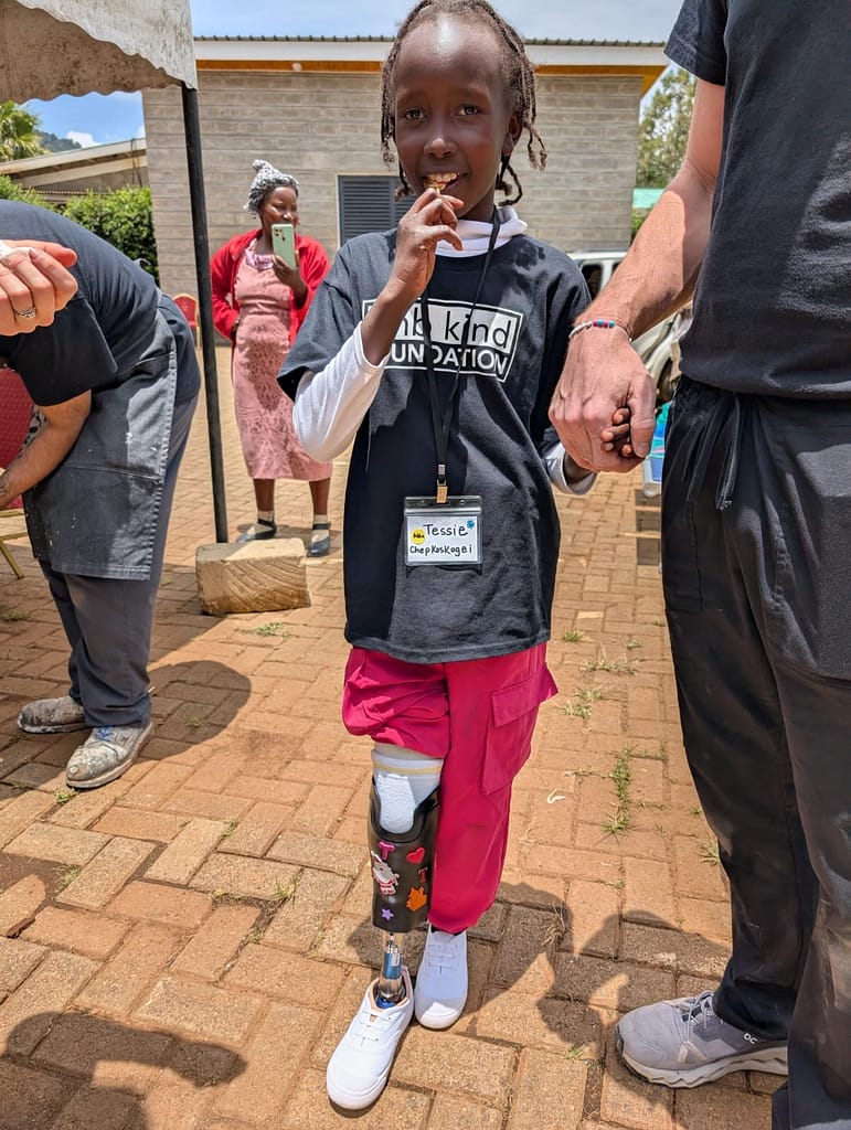 Scaling Impact Through Innovation: How 3D Printing Is Transforming Pediatric Prosthetics3DPrint.com | Additive Manufacturing Business 2 18747a2c b788 49ee b1f8 4c5abdf45668 1 JewtfY
