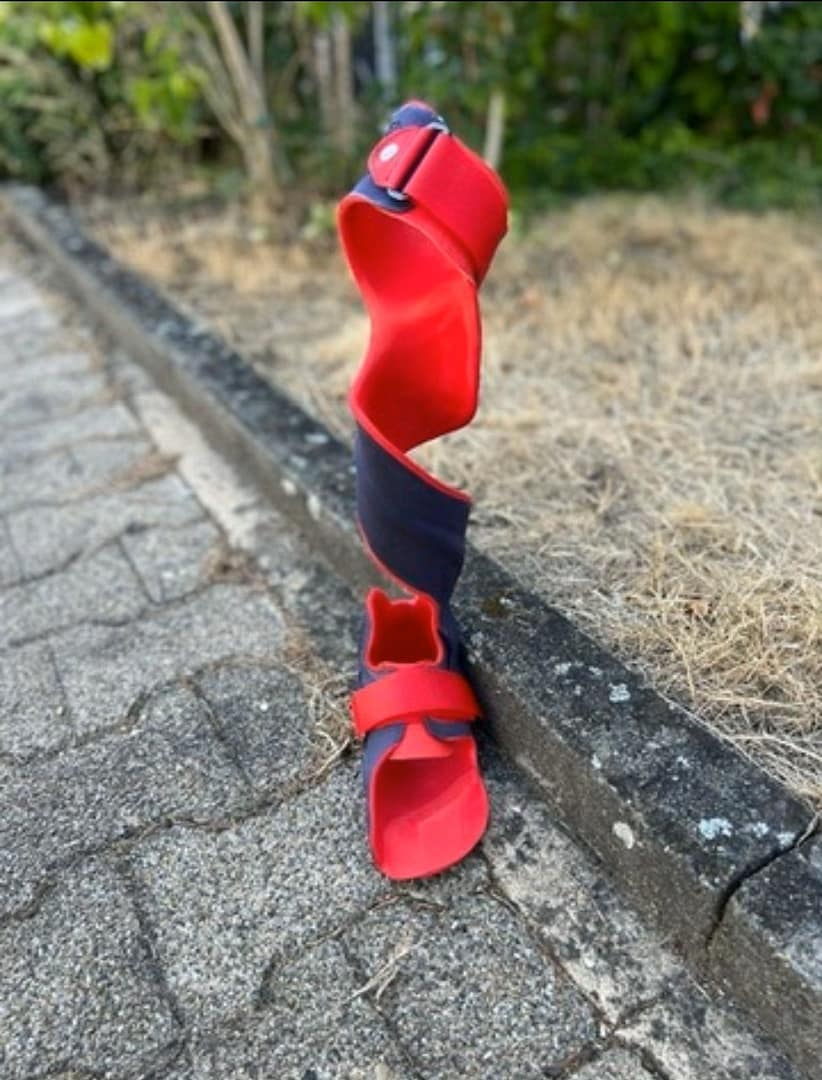 HP Dives Deeper Into Orthopedic 3D Printing at AOPA 2025 With New PA 113DPrint.com | Additive Manufacturing Business 6 Orfi 11 1 XAyP9X