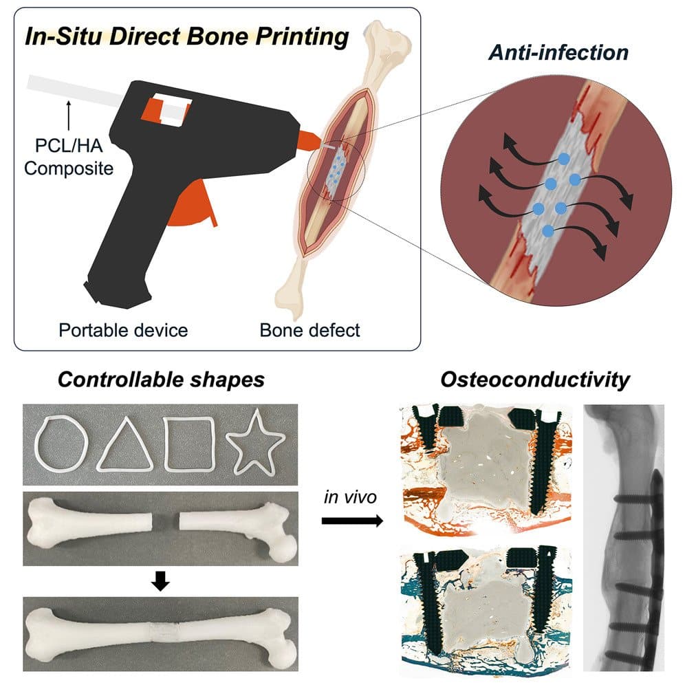 Handheld 3D Printer Repairs Bone Like a Glue Gun — Tested in Rabbits, Planned for OR Use3DPrint.com | Additive Manufacturing Business 1 Graphical abstract CREDIT Device Jeon et al AG2tJi